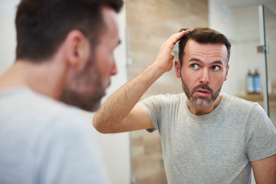 treat your hair loss